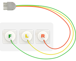 Kabel Konduktansi Cardiac Disposable